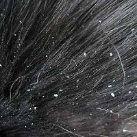 treat feline dandruff